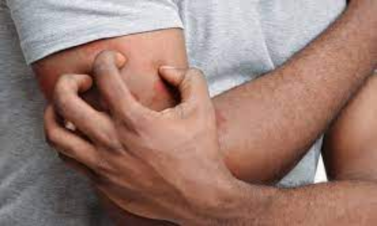 Home Remedies For Itching: मानसून सीजन में खुजली करने से मिलेगा छुटकारा, इन घरेलू उपायों को आज़माएं