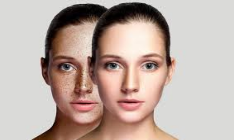 Remove Dark Spots : आपके चेहरे पर हो गए है डार्क स्पॉट, तो दूर करने के लिए अपनाएं ये आसान नुस्खा