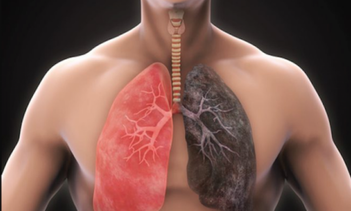Symptoms of Lungs Disease